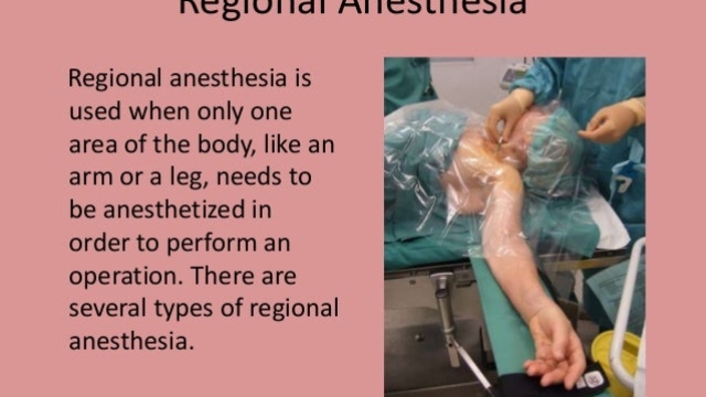 Awakening the Wonders: An Inside Look at Anesthesia