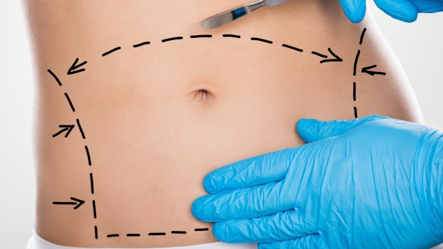 Transforming Your Tummy: Unveiling the Wonders of Abdominoplasty