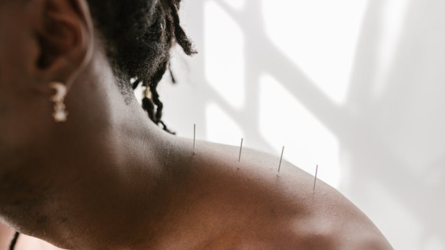 Understanding Pregnancy Chiropractor Services